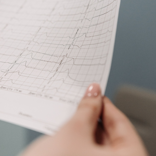 Spiroergometrie mit Laktatdiagnostik